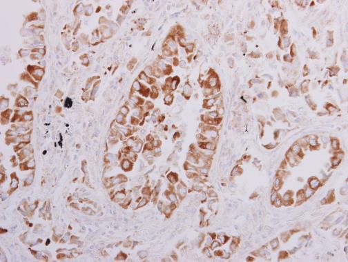 OSBPL6 antibody