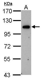 OSBPL6 antibody [C3], C-term