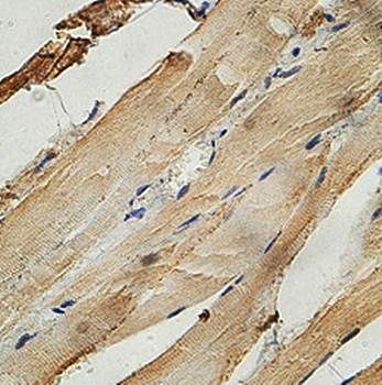 OSBPL6 Rabbit Polyclonal Antibody