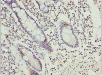 OSGEP Antibody