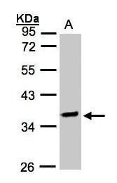 O-sialoglycoprotein endopeptidase Antibody