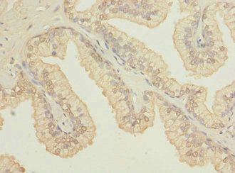 OSGEPL1 Antibody