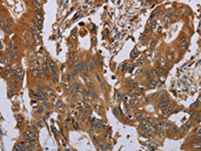 OSM Antibody