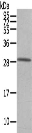 OSM Antibody