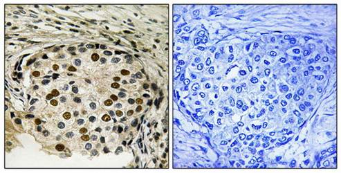 OSR1 (phospho-Thr185) antibody