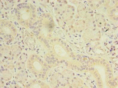 OSR2 Antibody