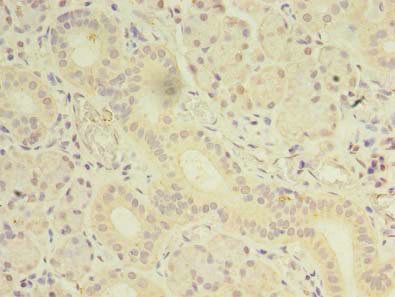 OSR2 antibody