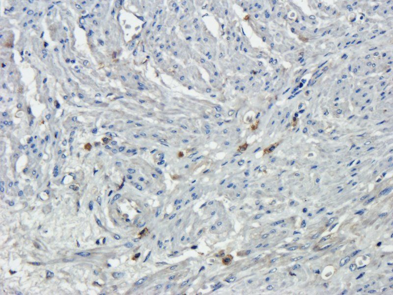 Osteocalcin antibody