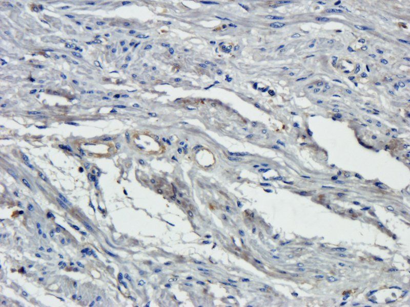 Osteocalcin antibody