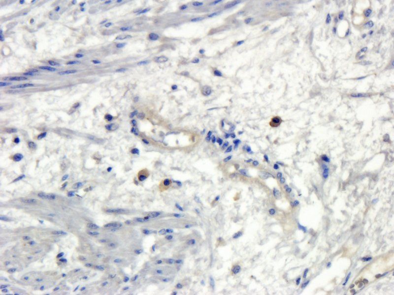 Osteocalcin antibody