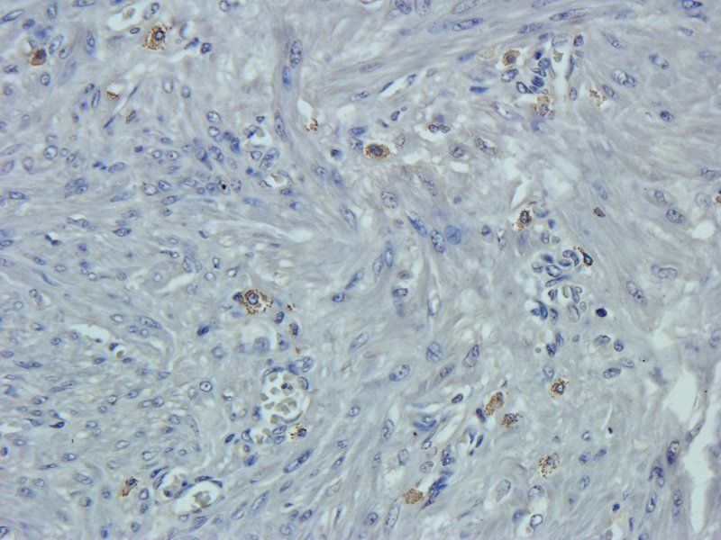 Osteocalcin antibody