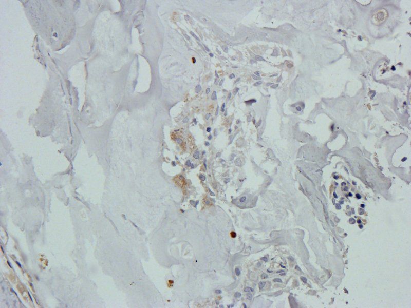 Osteocalcin antibody