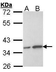 OTUB1 antibody [N1C1]