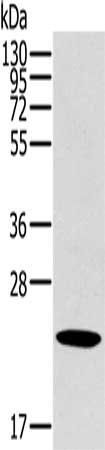 OTUB2 Antibody