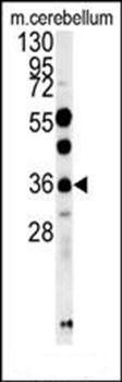 OTUD6B antibody