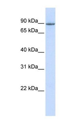 OTUD7B antibody