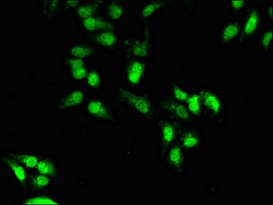 OTX1 antibody