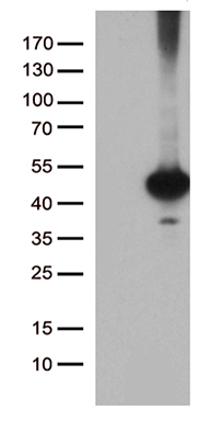 OTX2 Antibody