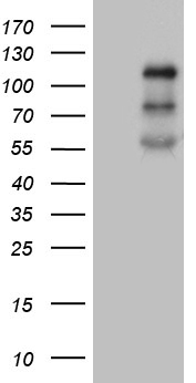 OTX2 Antibody