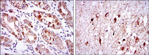 OTX2 Antibody