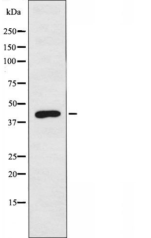 OXER1 Antibody