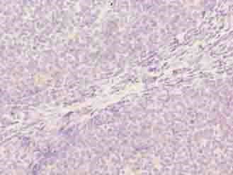 OXSM Antibody