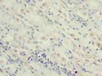 OXSM Antibody