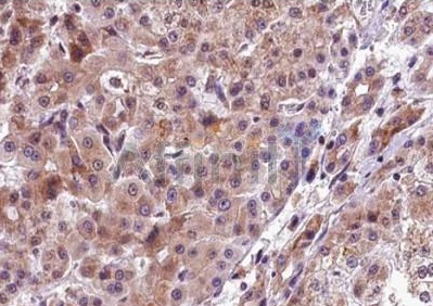 p-PERK (Thr 982) antibody