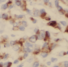 p115, USO1 antibody