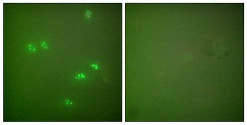 p14 ARF antibody