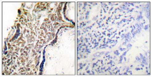 p14 ARF Antibody