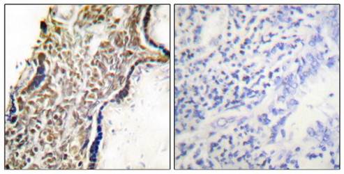 p14 ARF antibody