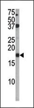 p16 -INK4A (phospho-Ser140) antibody