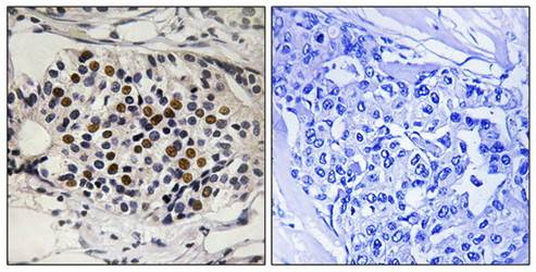 CDKN2A (phospho-Ser152) antibody