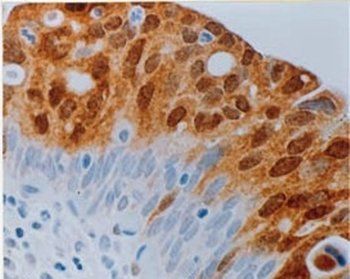 Mouse anti Human p16 - ink4a Antibody