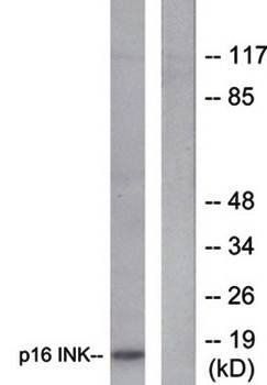p16 INK Antibody