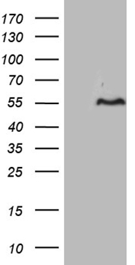 p16INK4A Antibody