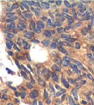 P21 Rabbit Polyclonal Antibody