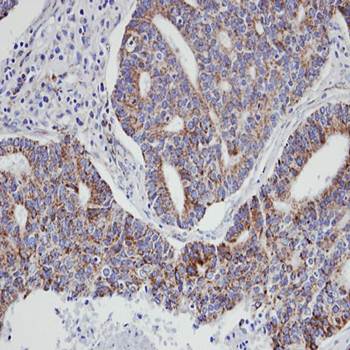 p21-ARC antibody