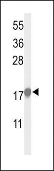 P21Cip1-S130 antibody