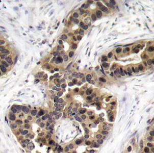 p21Cip1 (Phospho-Thr145) Antibody