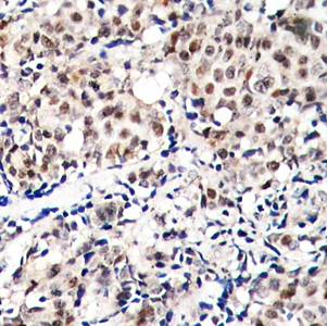 p27Kip1 (Phospho-Thr187) Antibody