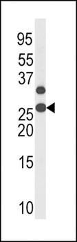 p27Kip1 (phospho-Thr187) antibody