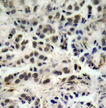 p27Kip1 (Ab0)Antibody