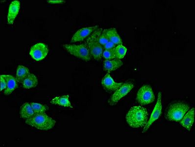 P2RX1 antibody