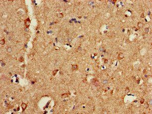 P2RX1 Antibody