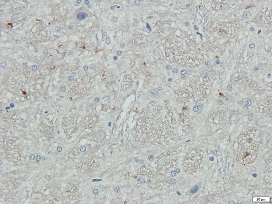 P2RX4 antibody