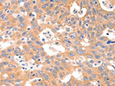 P2RY11 Antibody