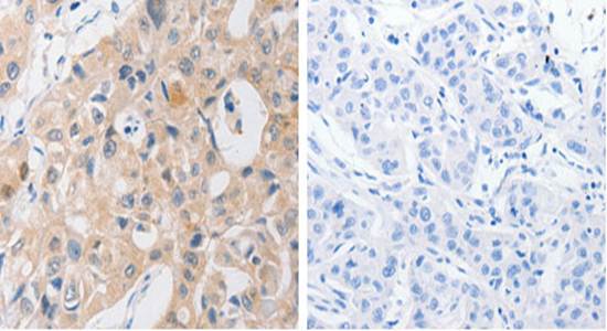 P2RY11 Antibody