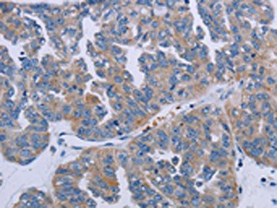 P2RY2 Antibody